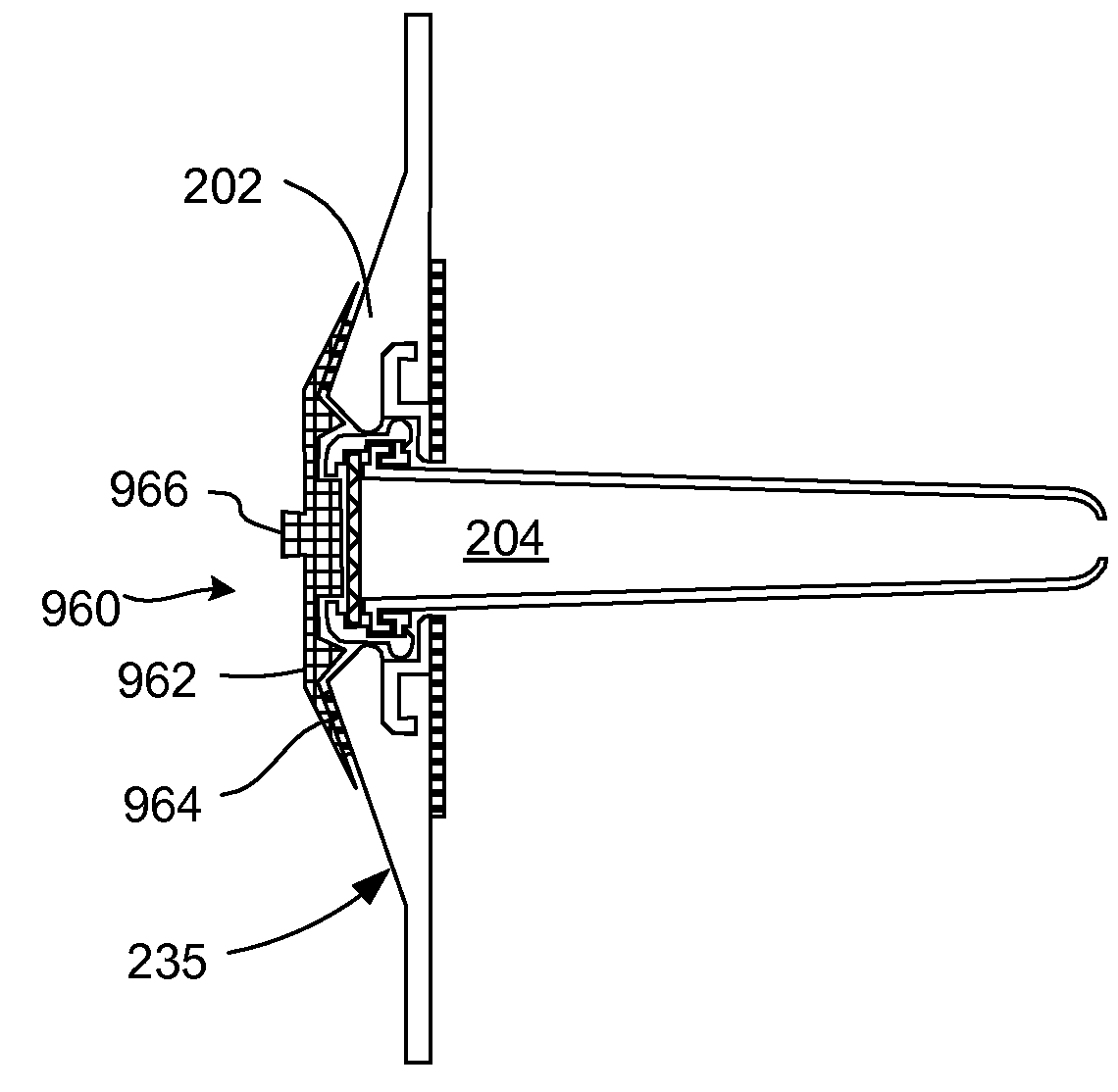 Pneumostoma management method for the treatment of chronic obstructive pulmonary disease