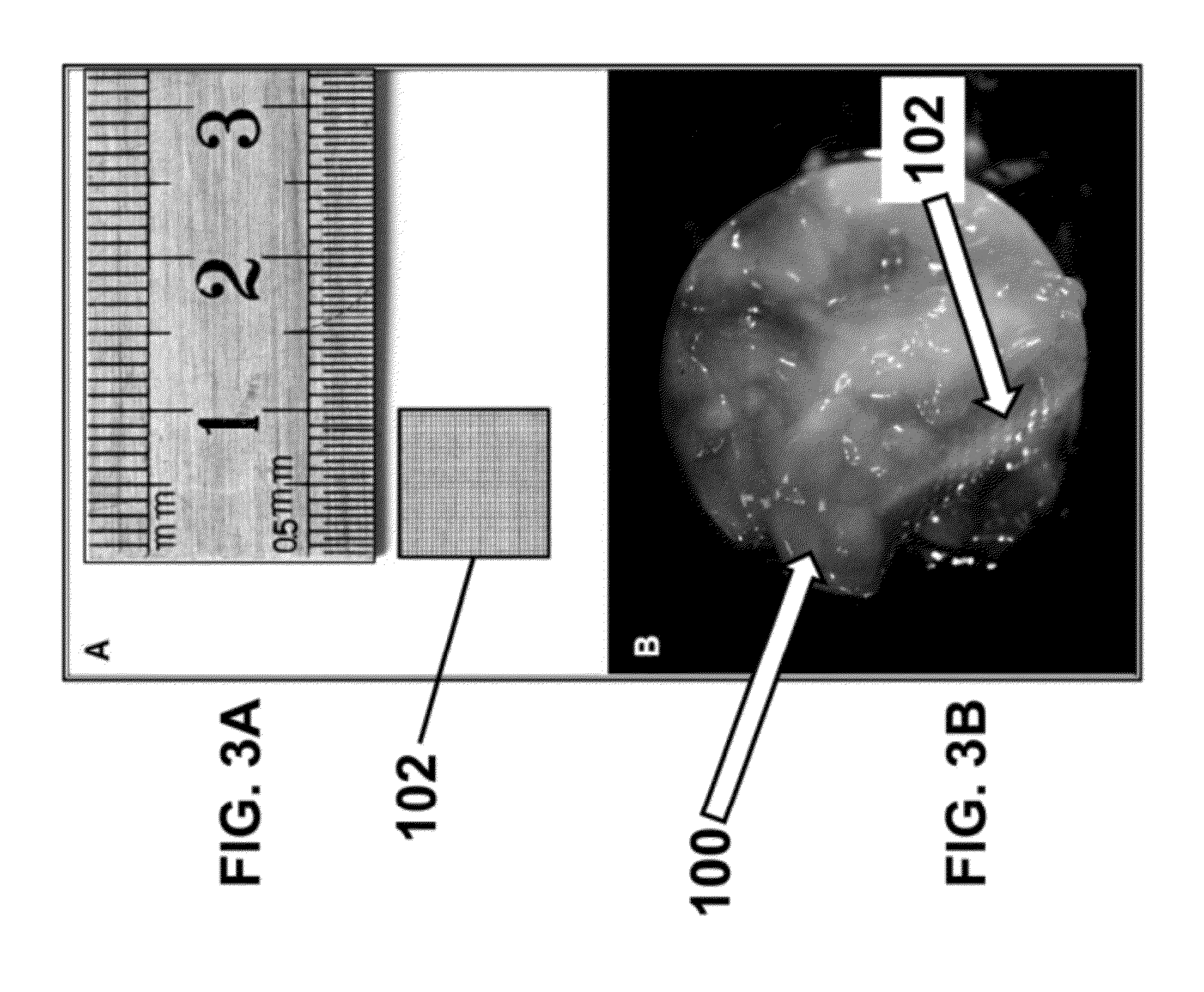 Mesh enclosed tissue constructs