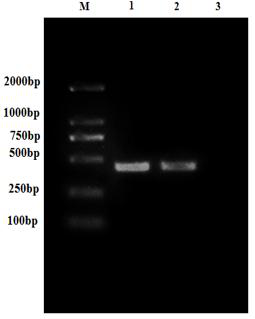 A kind of perch rhabdovirus recombinant g2 protein and its application