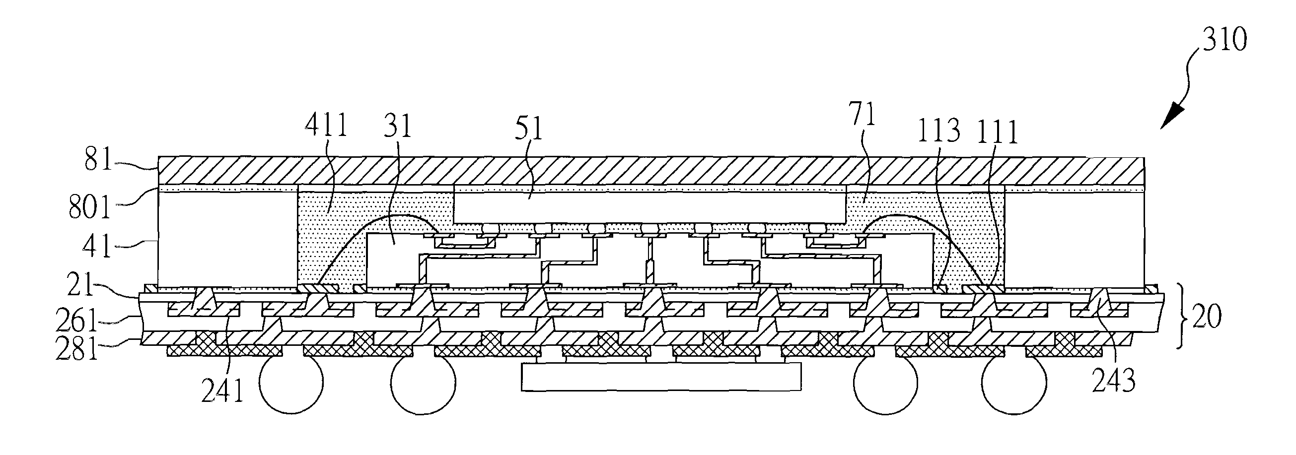 Semiconductor assembly with dual connecting channels between interposer and coreless substrate