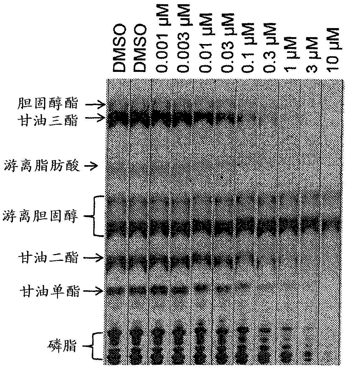 Use of acetyl-coa carboxylase inhibitors for treating acne vulgaris