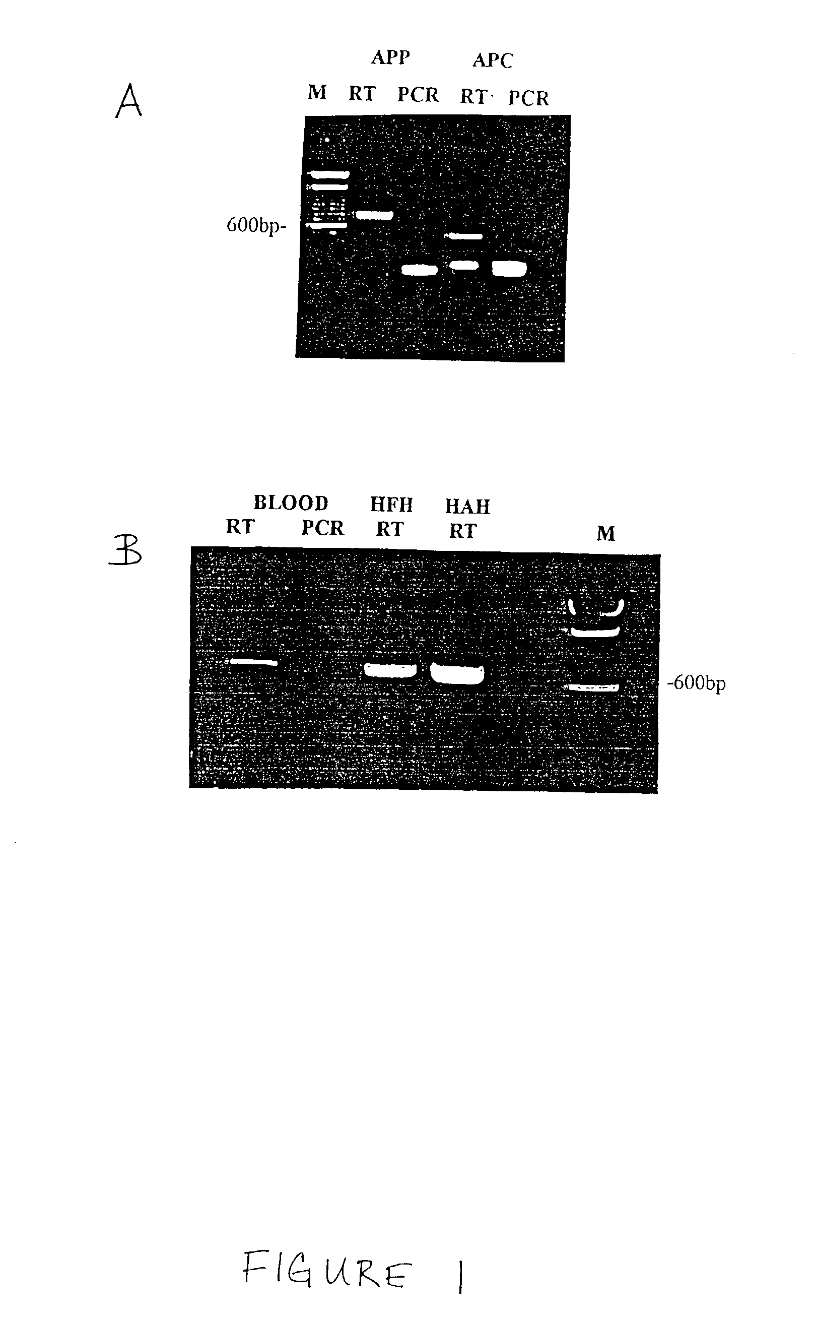 Method for the detection of gene transcripts in blood and uses thereof