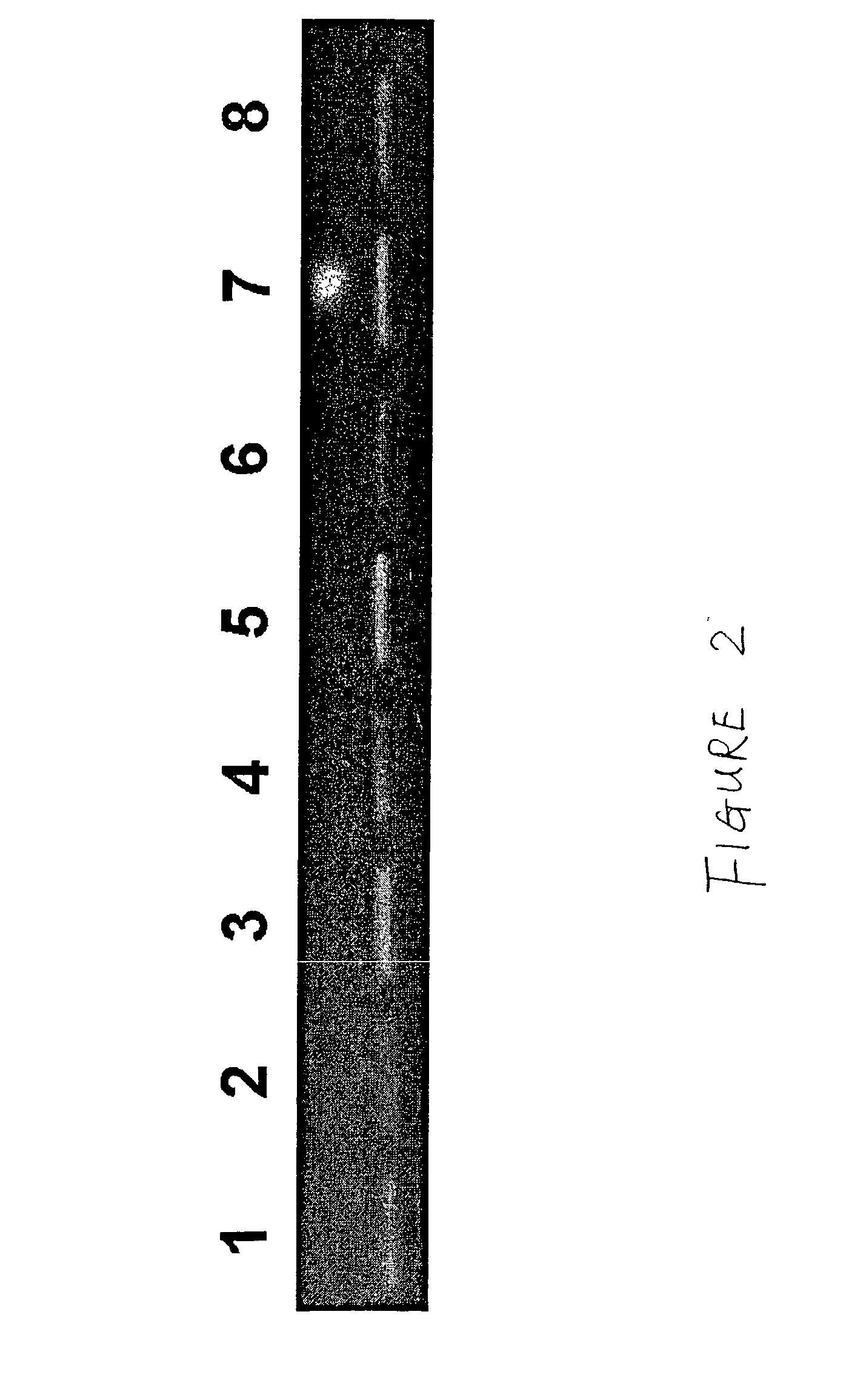 Method for the detection of gene transcripts in blood and uses thereof