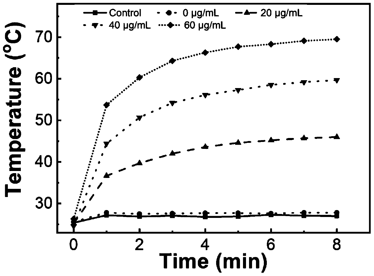 Temperature-sensitive hydrogel with visual diagnosis and treatment of infected wound and preparation method of hydrogel