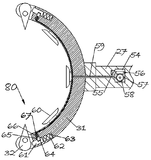 Installer-remover for orthodontics