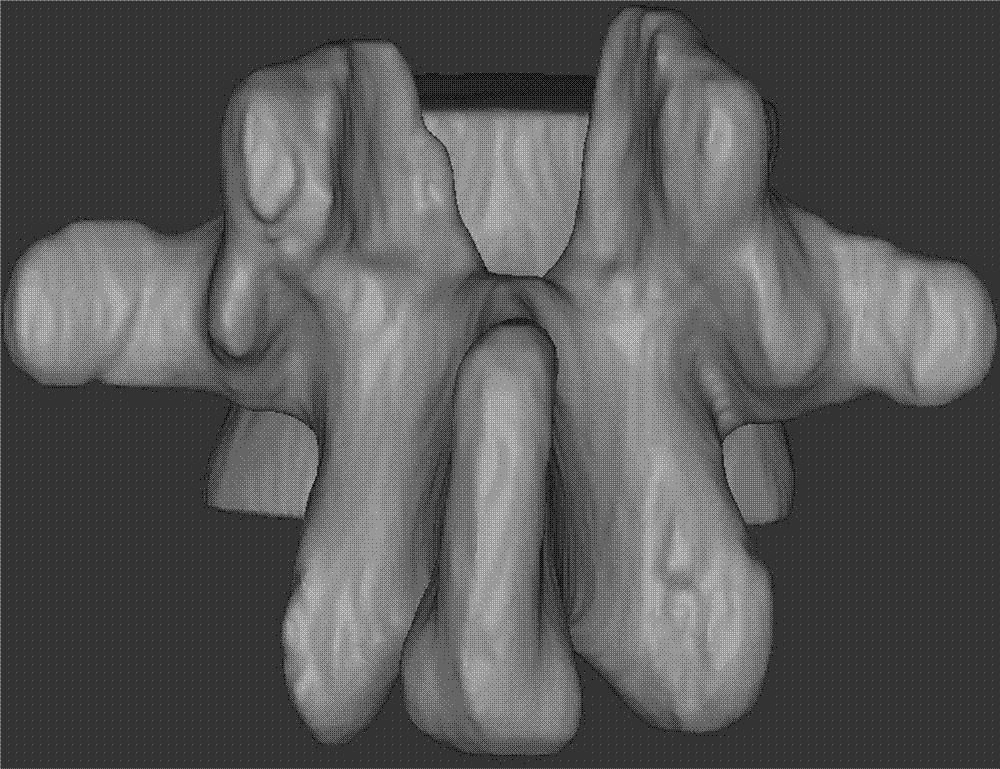 Method for utilizing three-dimensional modeling for looking for optimum inserting point for inserting pedicle screw