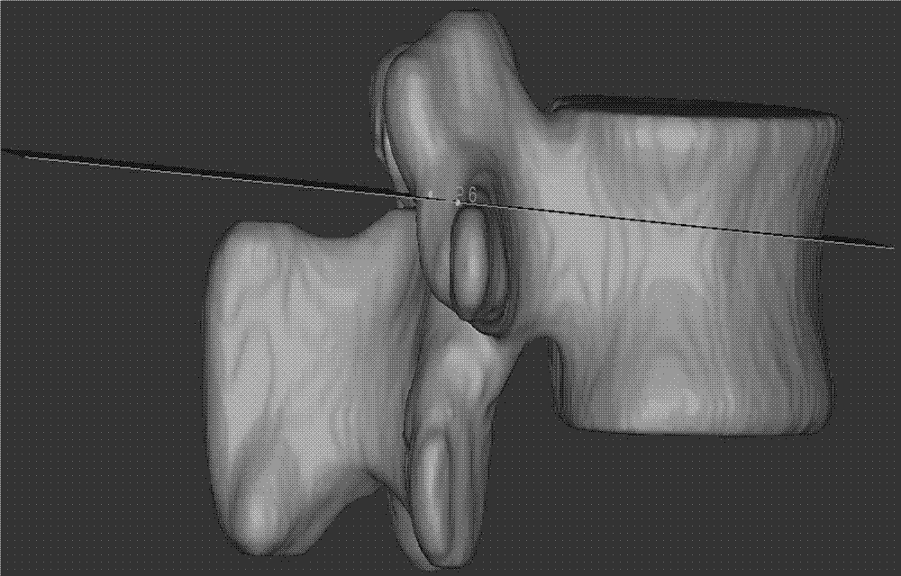 Method for utilizing three-dimensional modeling for looking for optimum inserting point for inserting pedicle screw