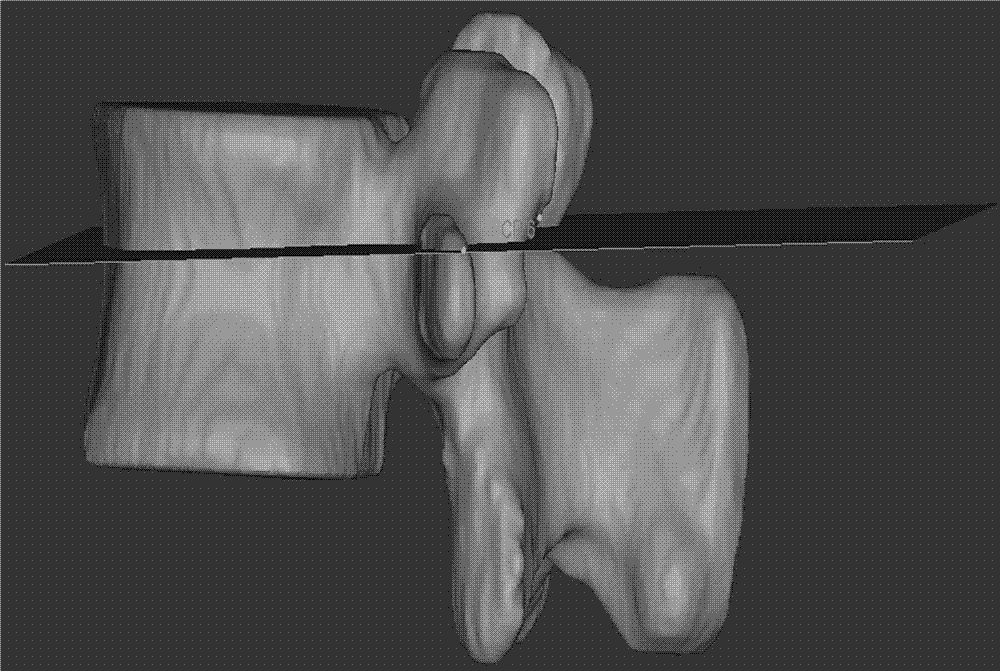 Method for utilizing three-dimensional modeling for looking for optimum inserting point for inserting pedicle screw