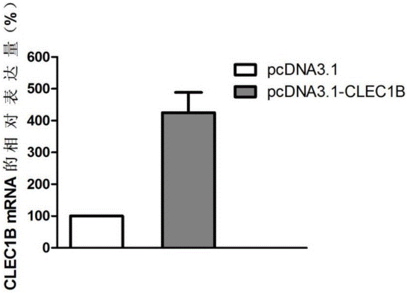 Application of CLEC1B (C-type lectin domain family 1 member B) genes on diagnosis and treatment of bile duct carcinoma