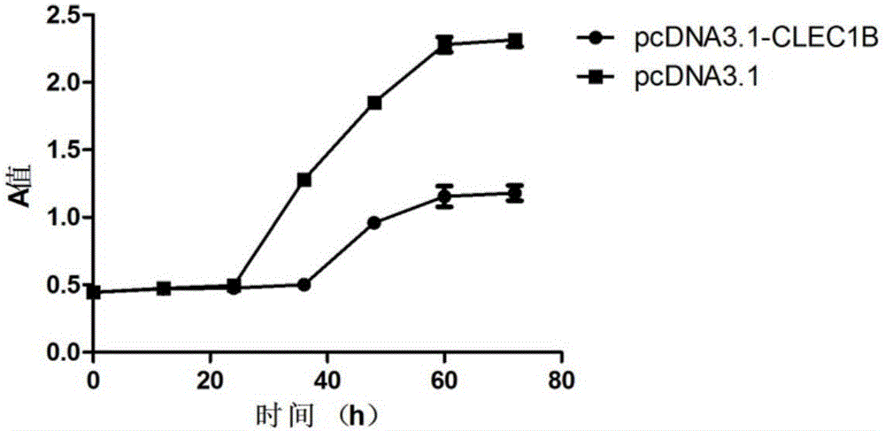 Application of CLEC1B (C-type lectin domain family 1 member B) genes on diagnosis and treatment of bile duct carcinoma