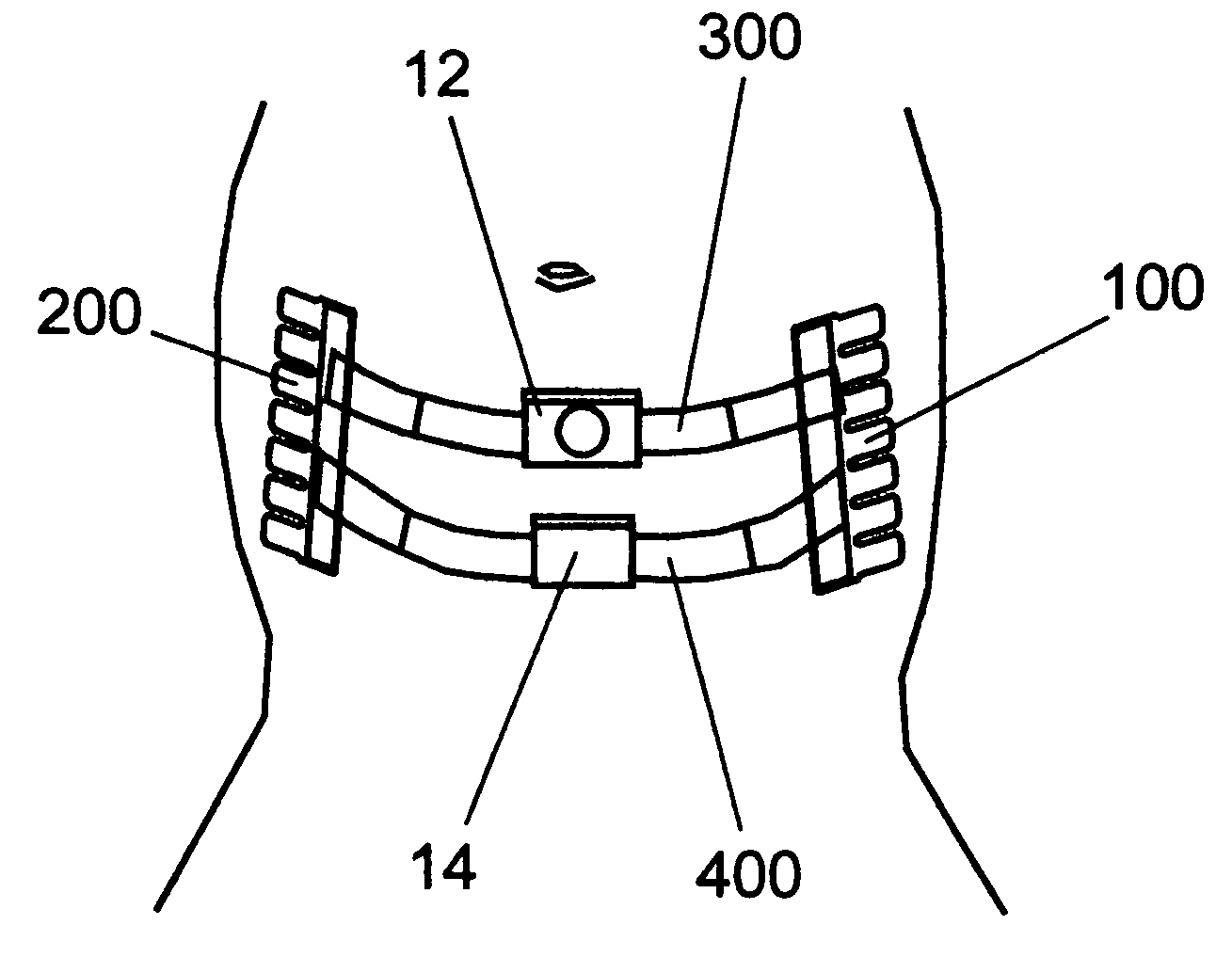 System, method, and kit for positioning a monitor transducer on a patient