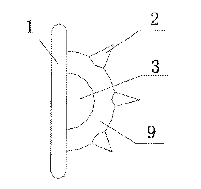 Orthodontic functional appliance