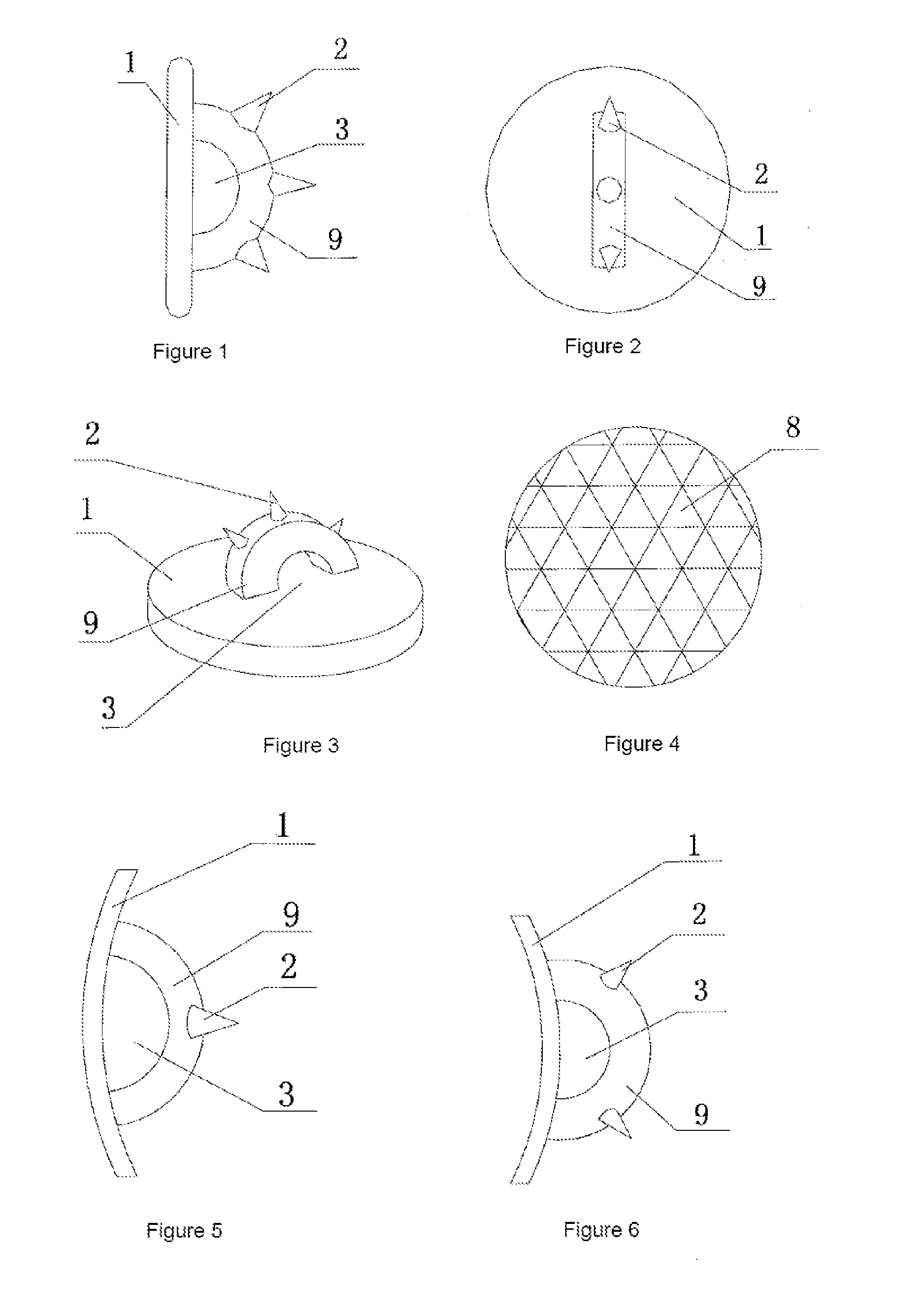 Orthodontic functional appliance