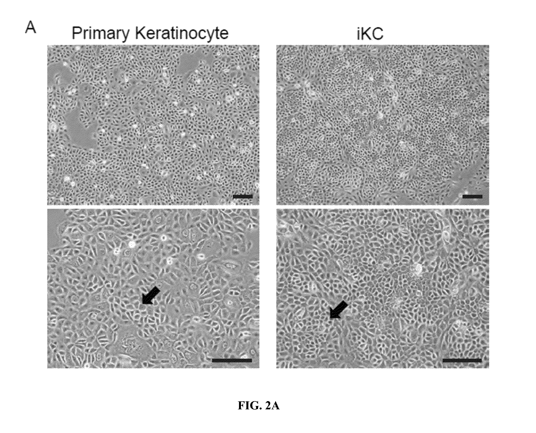 Generation of keratinocytes from pluripotent stem cells and maintenance of keratinocyte cultures