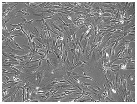 Inducing medium and method for inducing fibroblasts to secrete antimicrobial peptide, fibroblasts and application