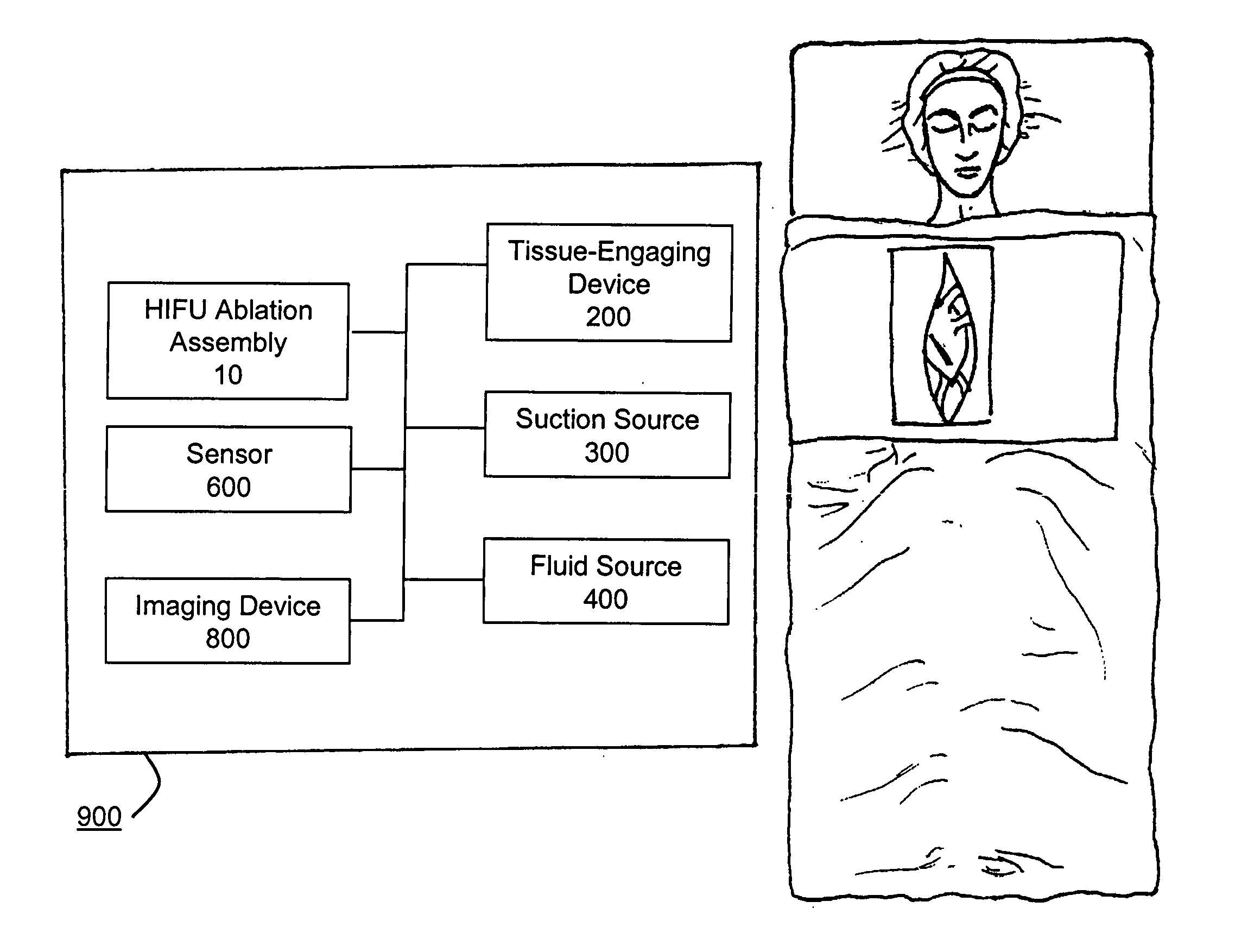 Method for guiding a medical device