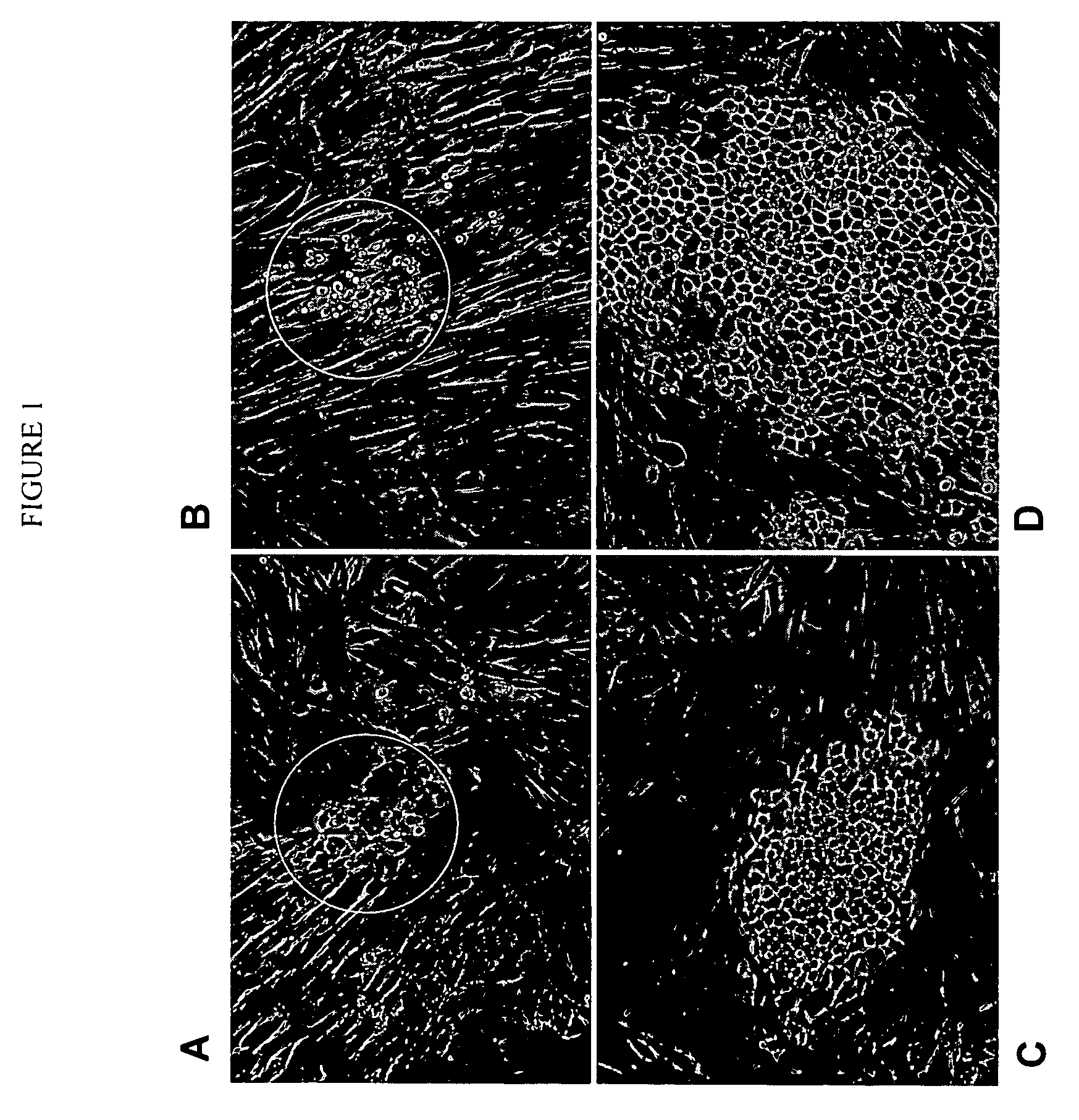 Human cancer stem cells