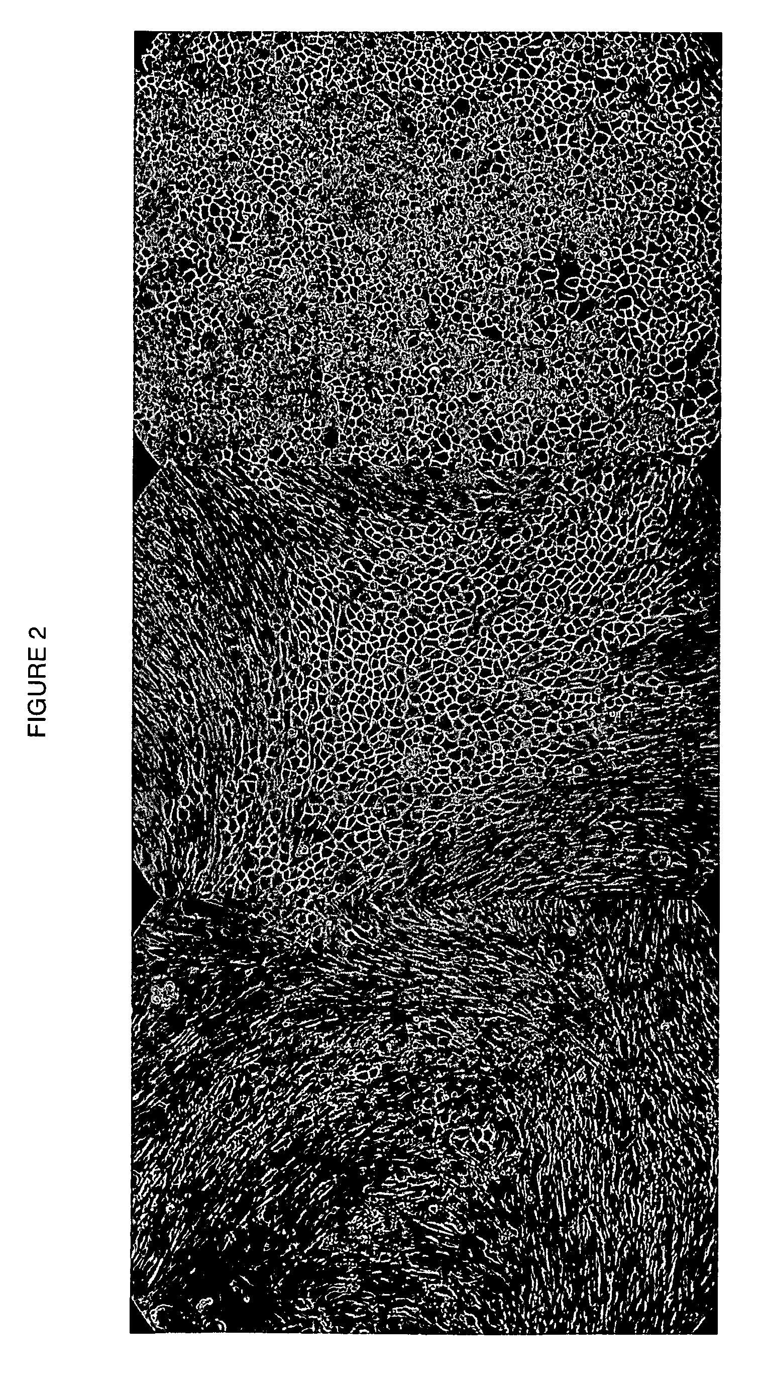 Human cancer stem cells