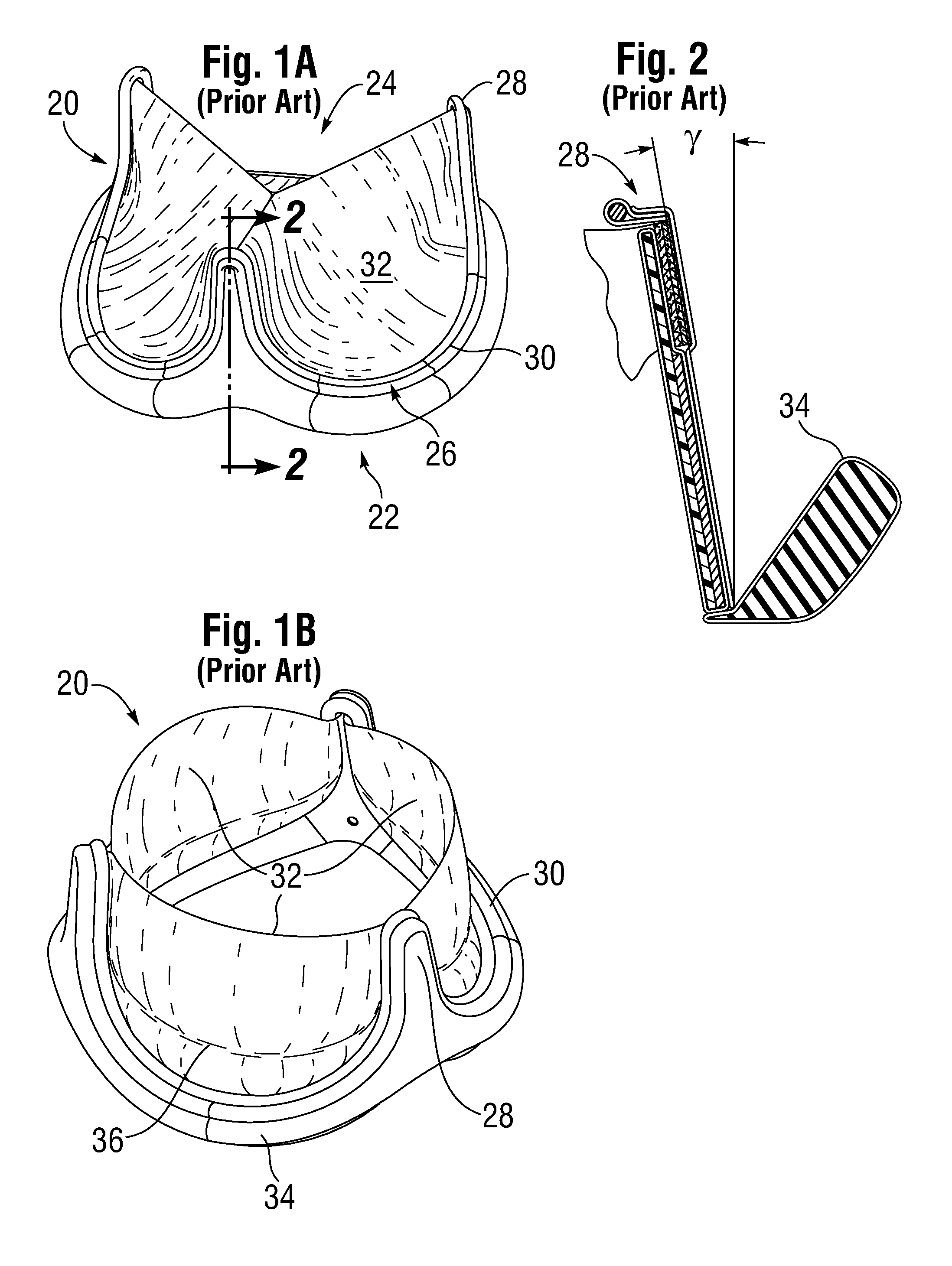 Low gradient prosthetic heart valve