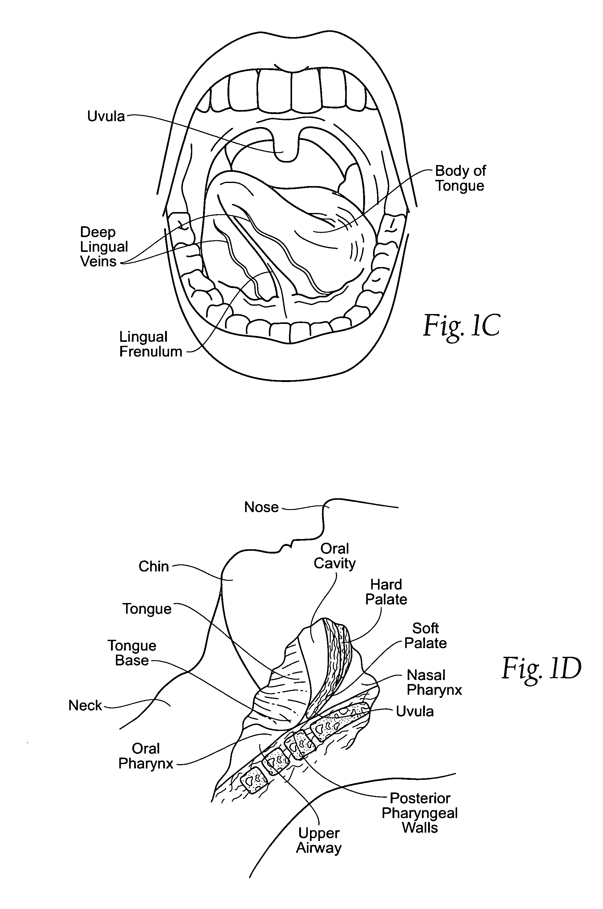 Implantable devices, systems, and methods for maintaining desired orientations in targeted tissue regions