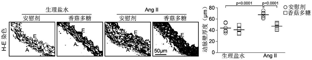 Application of lentinan to prevention or treatment of cardiovascular and cerebrovascular diseases