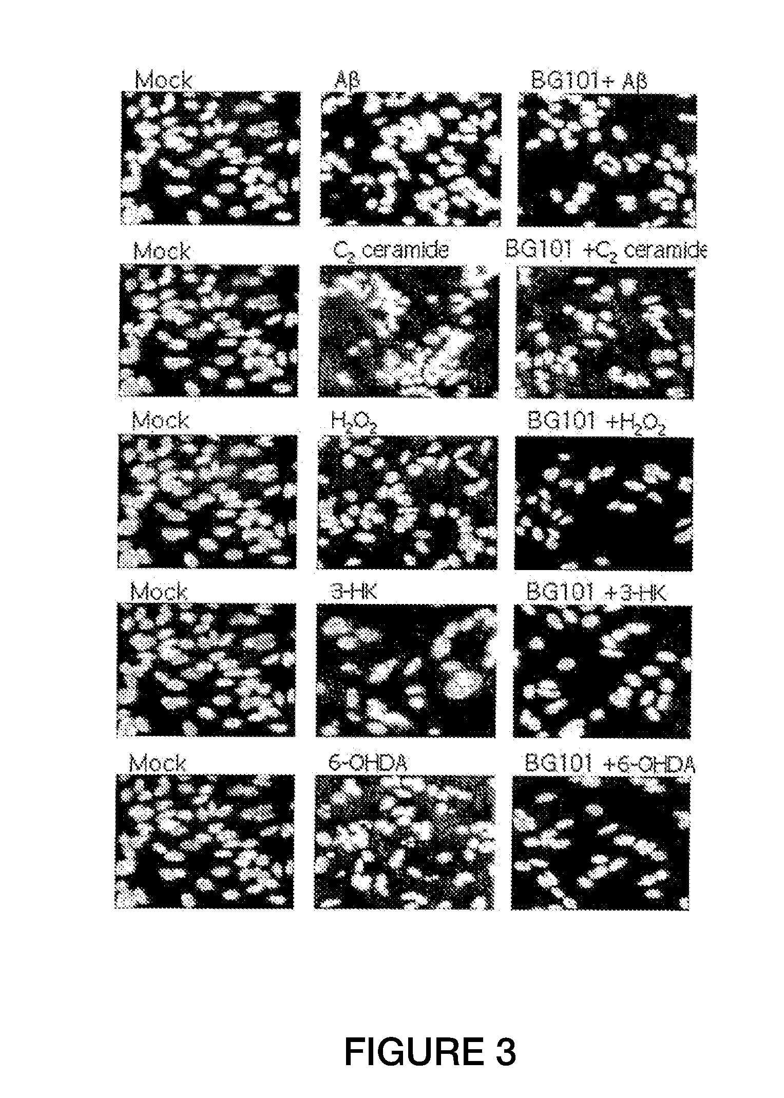 Silk Peptide For Improving Neuroprotective And Neurofunctional Effects And A Method Of Its Prepartion