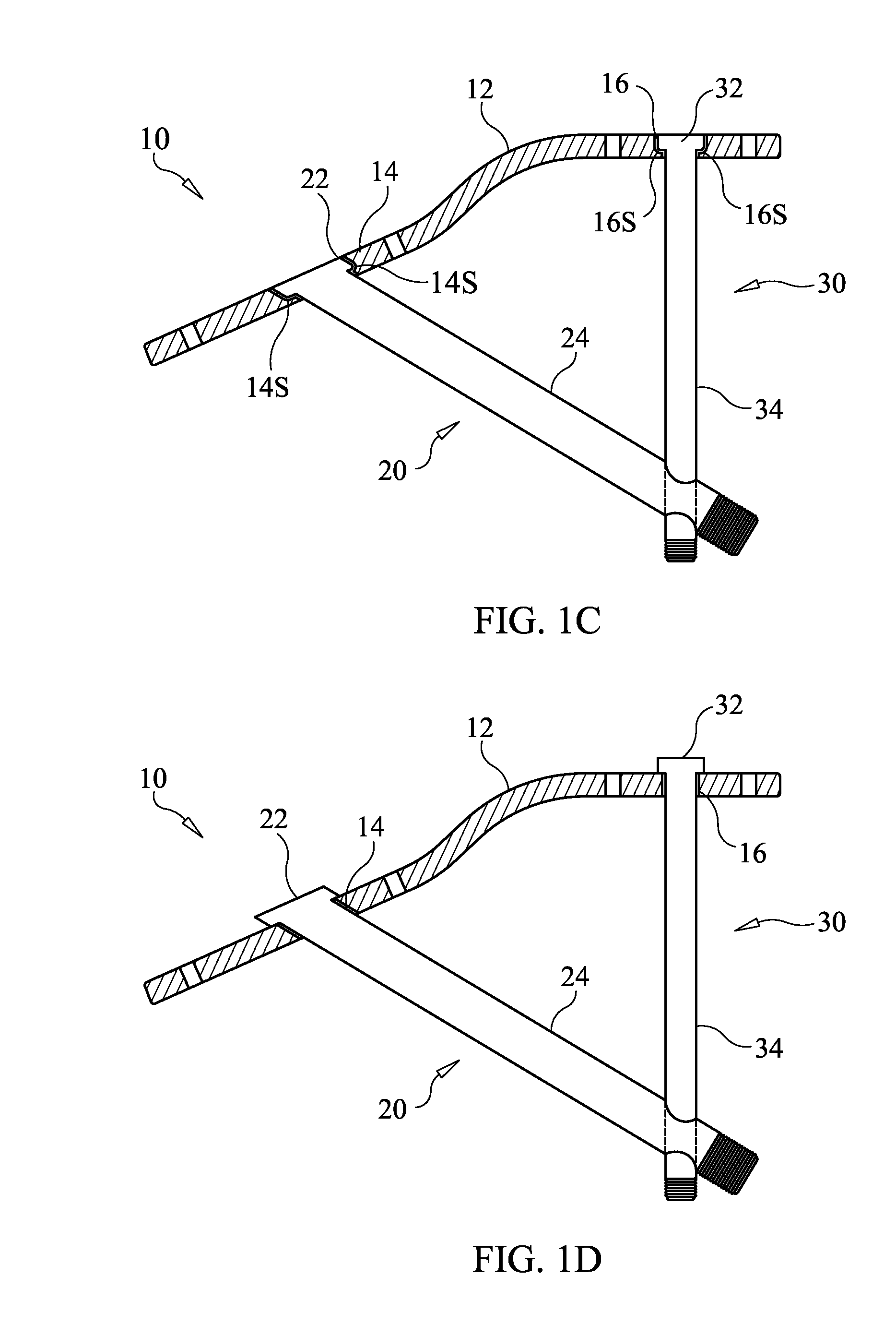 Bone Securement Apparatus and Method