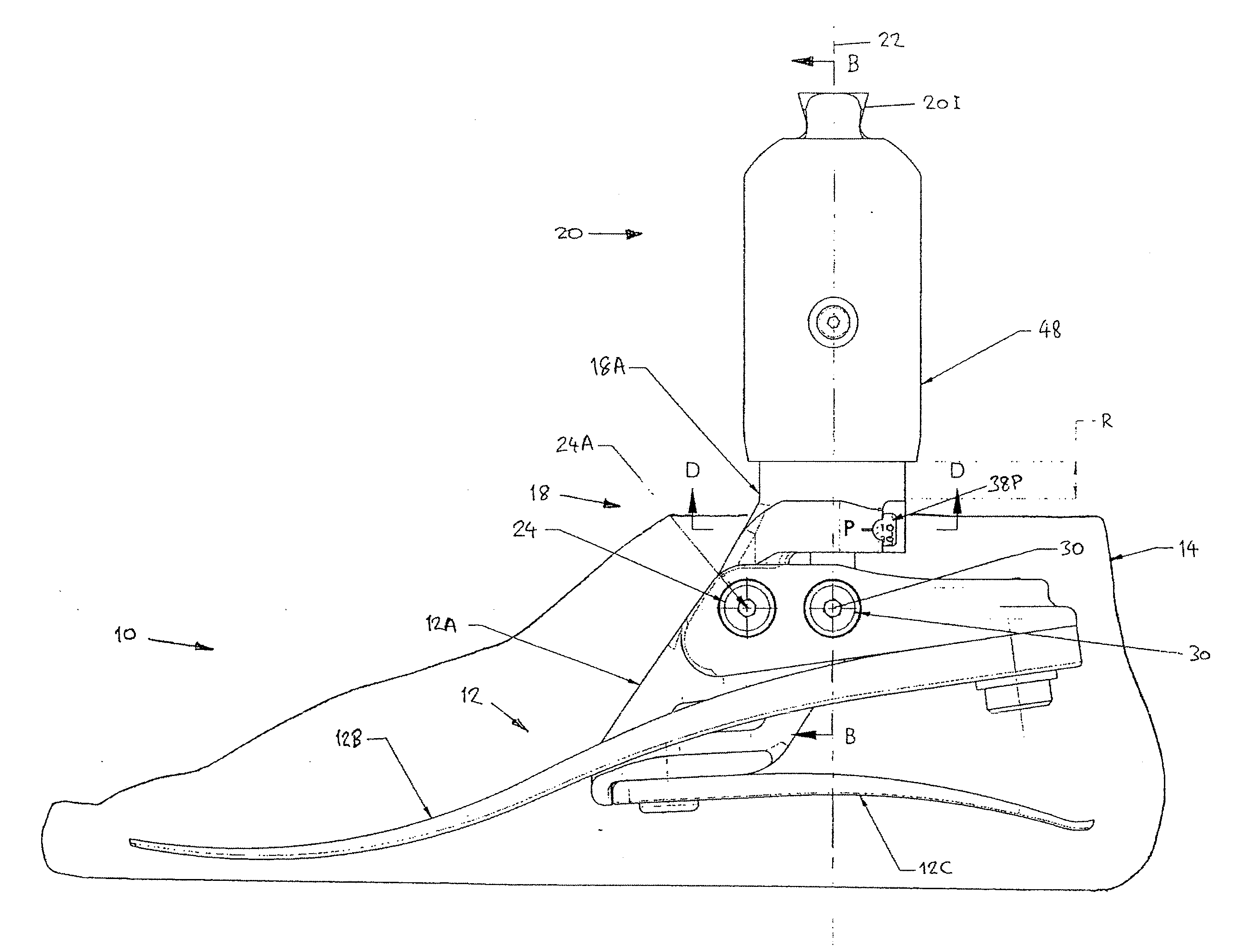 Lower Limb Prosthesis