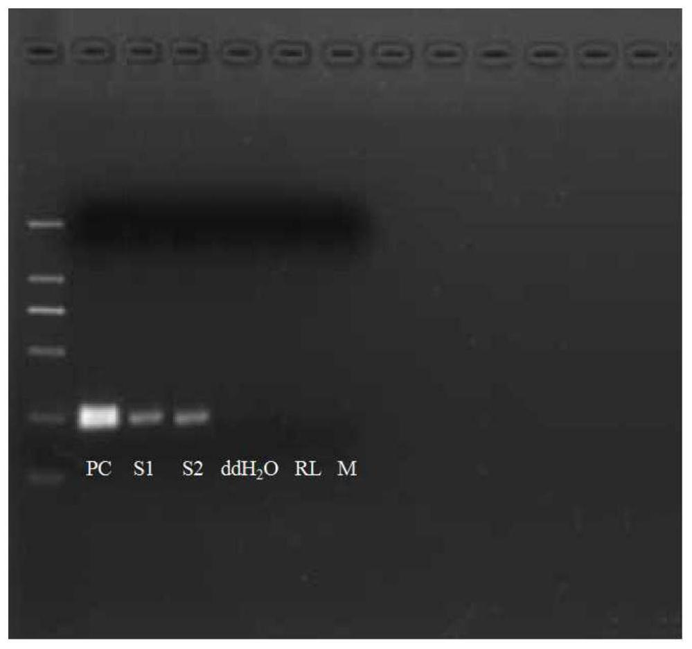 Primer group, system, kit and method for detecting aphelenchoides besseyi