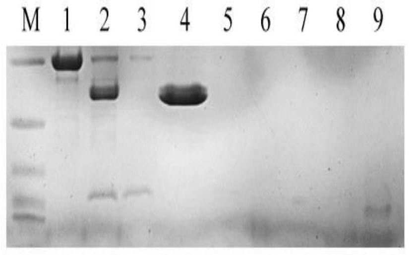 Recombinant human insulin and purification and preparation method thereof