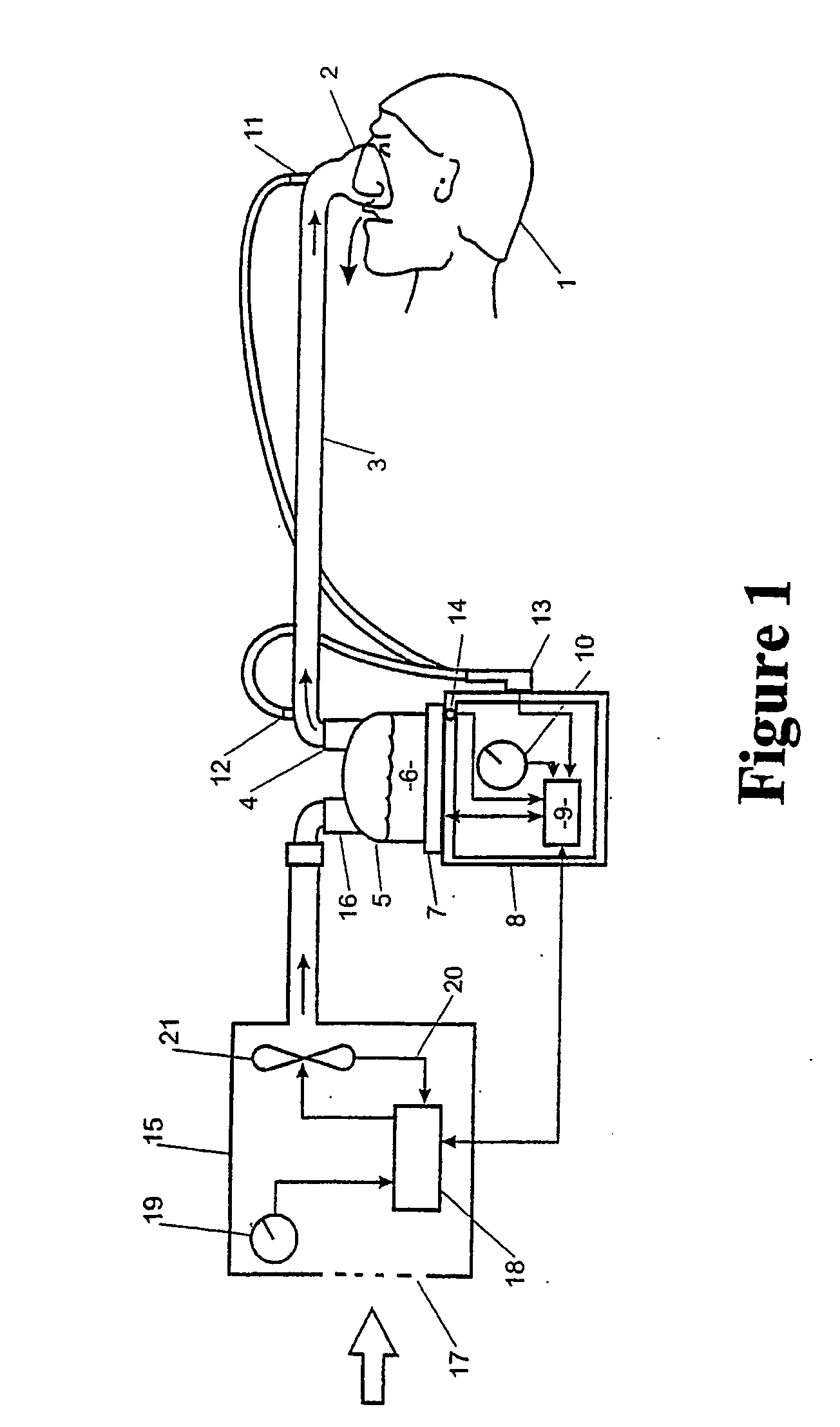 Respiratory apparatus and methods of respiratory treatment