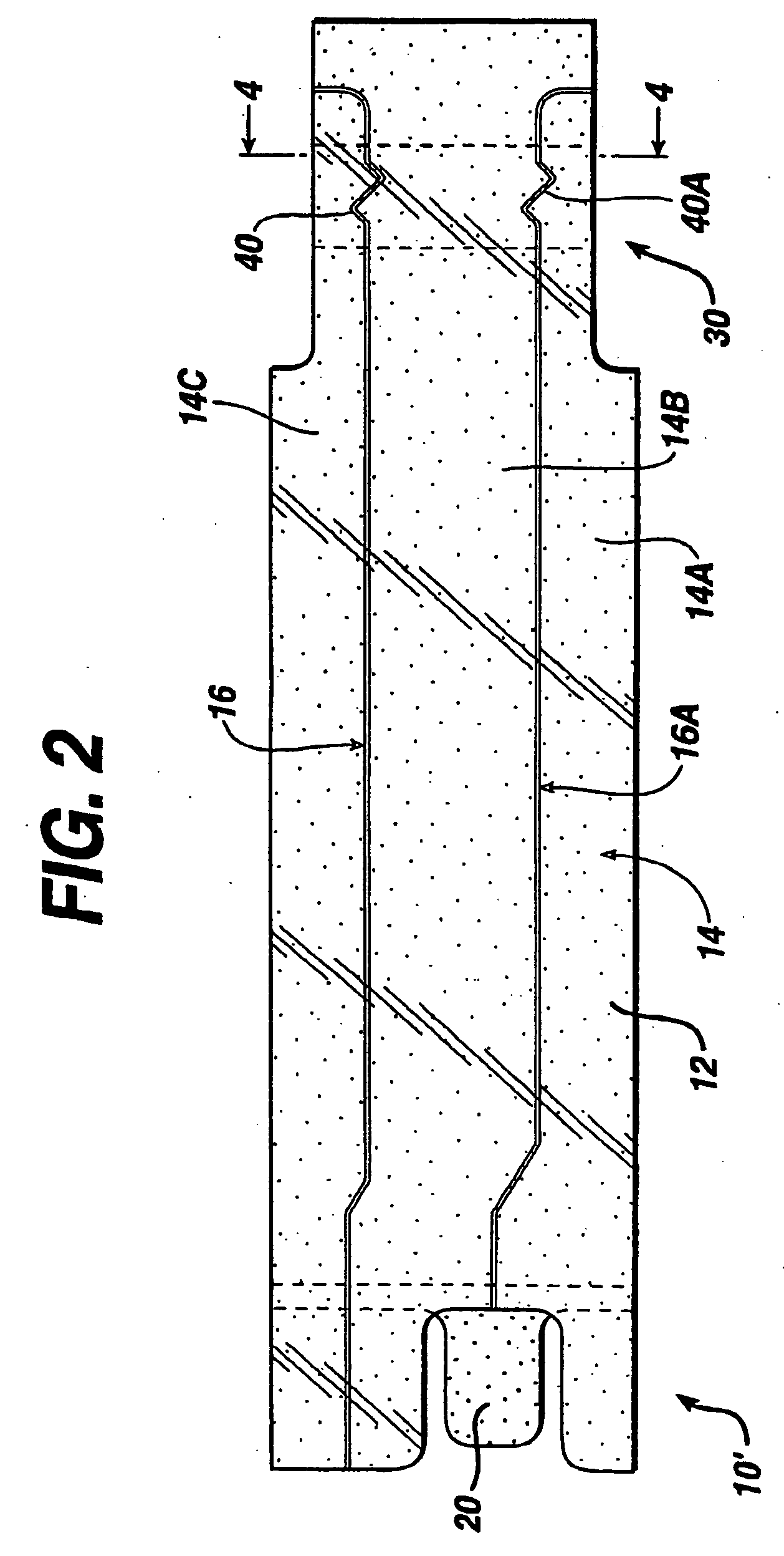 Electrically-conductive patterns for monitoring the filling of medical devices