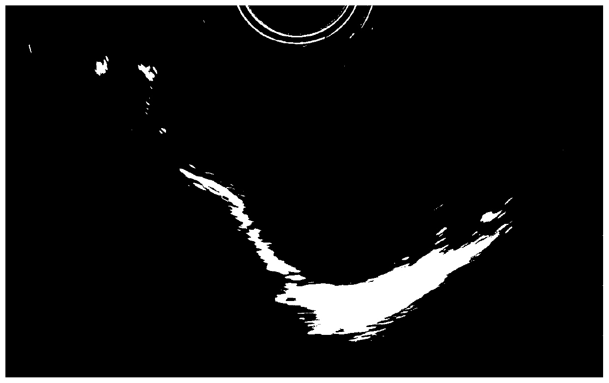 Ovary and/or follicle automatic measurement method based on two-dimensional image