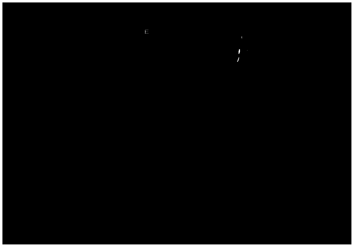 Ovary and/or follicle automatic measurement method based on two-dimensional image