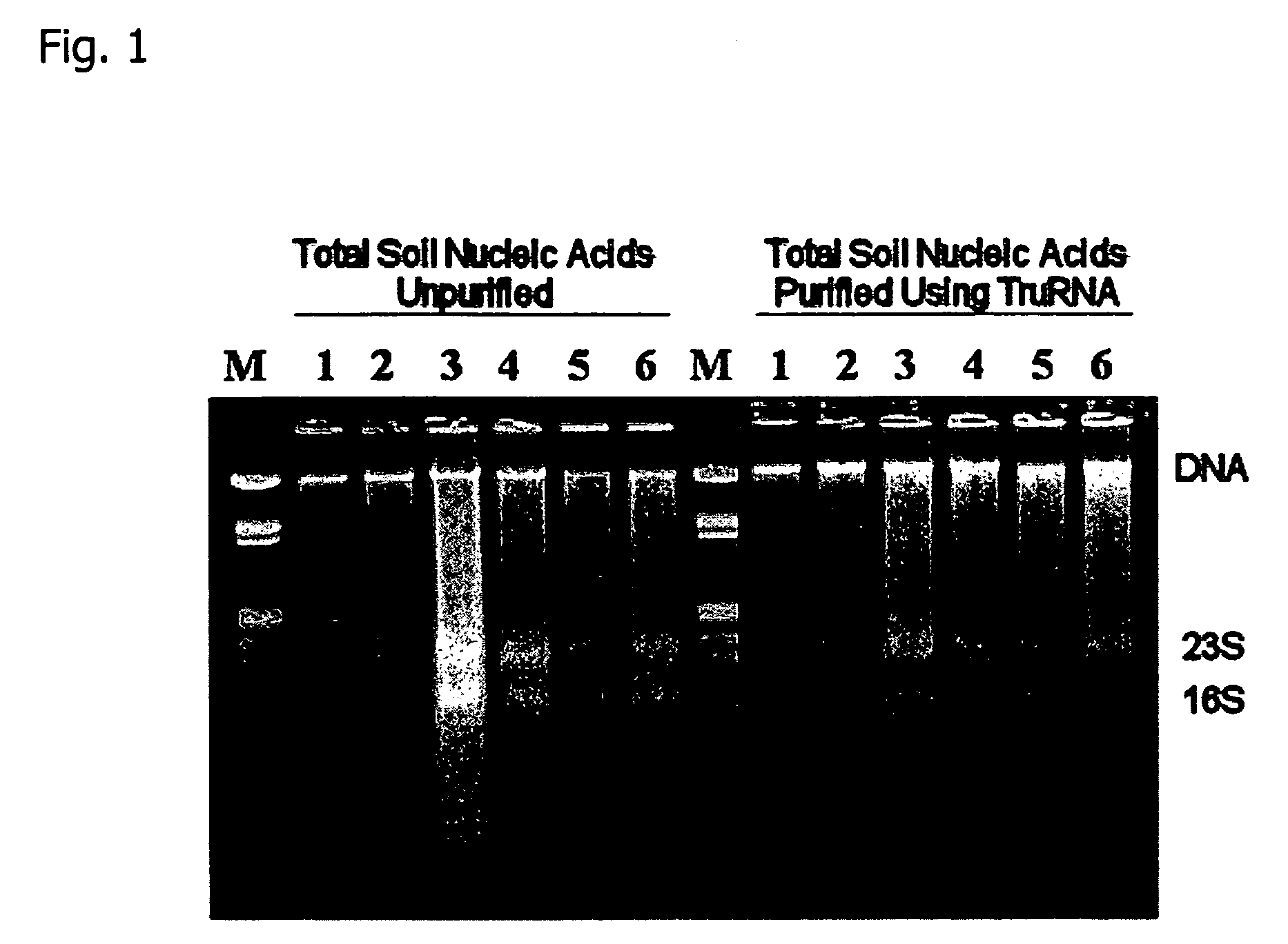 Extraction of high-purity DNA and RNA