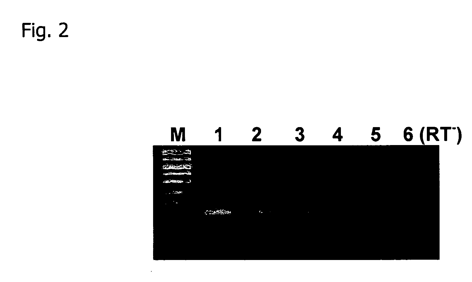 Extraction of high-purity DNA and RNA