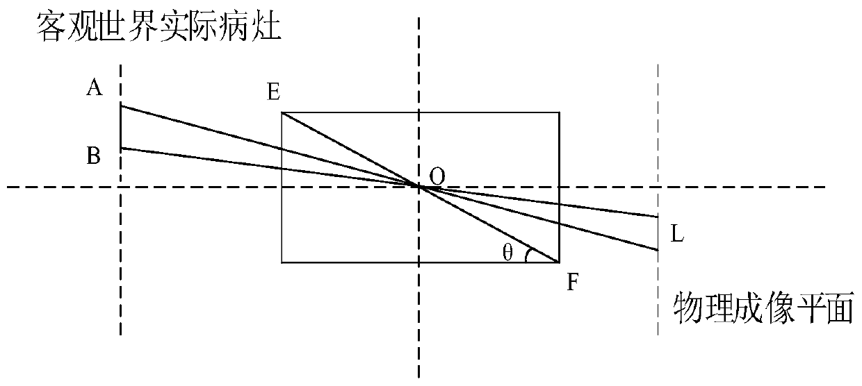 Lesion size measurement method and system of fluorescence endoscope and computer equipment