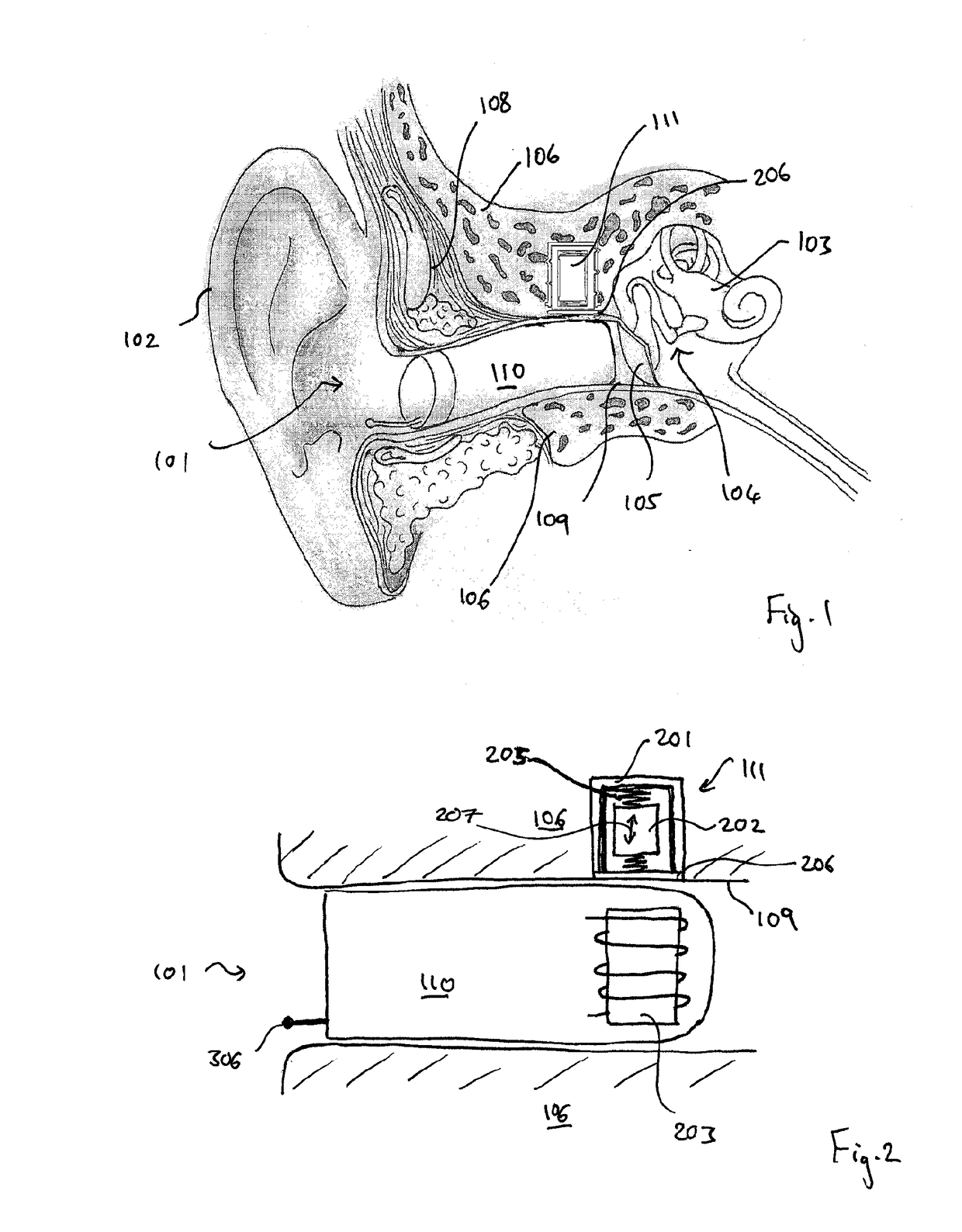 Hearing aid