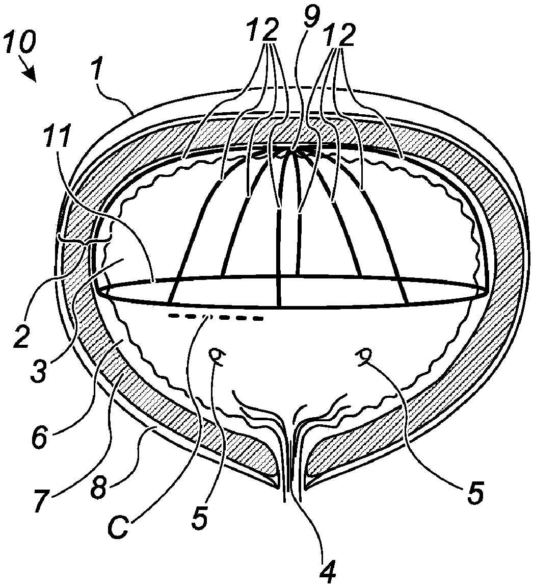 Devices for far field bipolar ablation