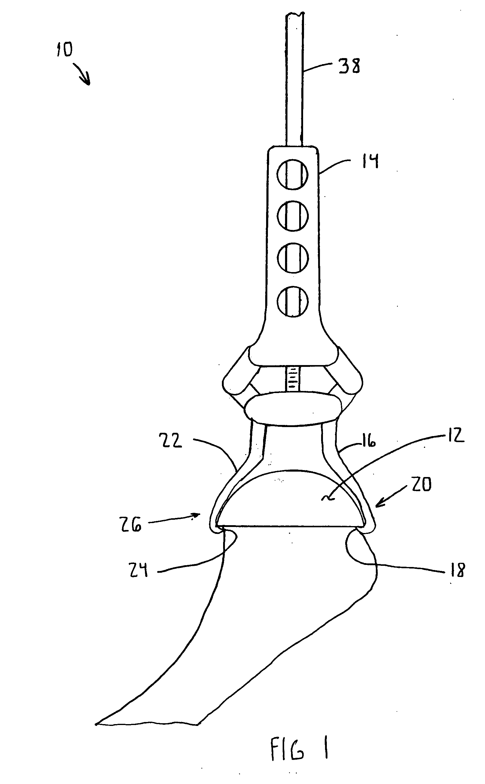 Surface replacement extractor device and associated method