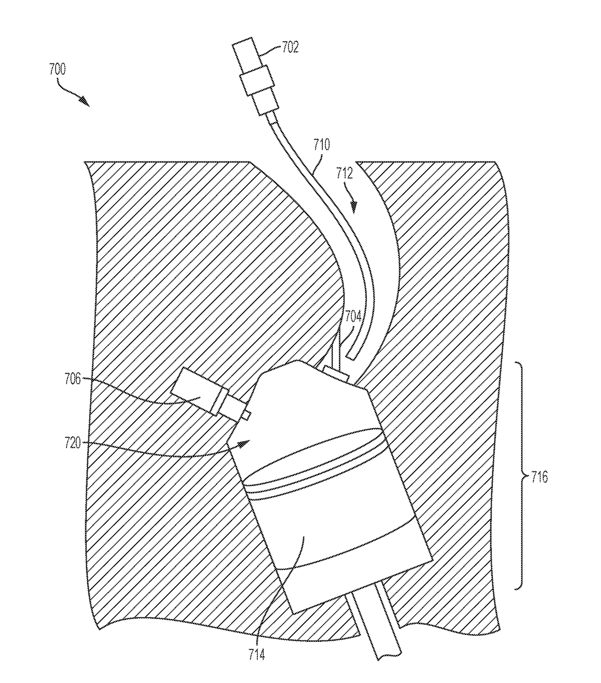 Method of Generating and Distributing a Second Fuel for an Internal Combustion Engine