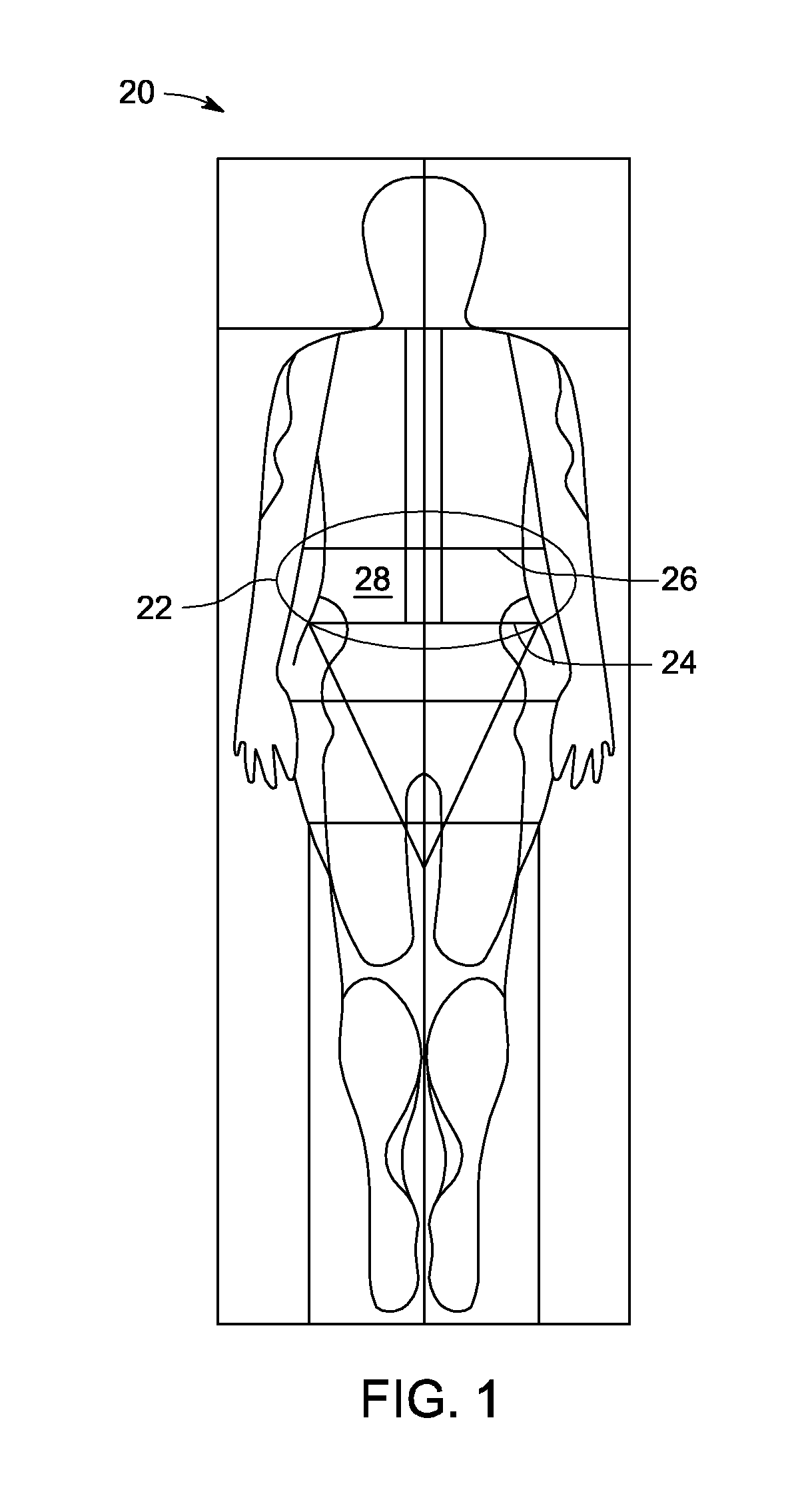 Method and system to improve visceral adipose tissue estimate by measuring and correcting for subcutaneous adipose tissue composition