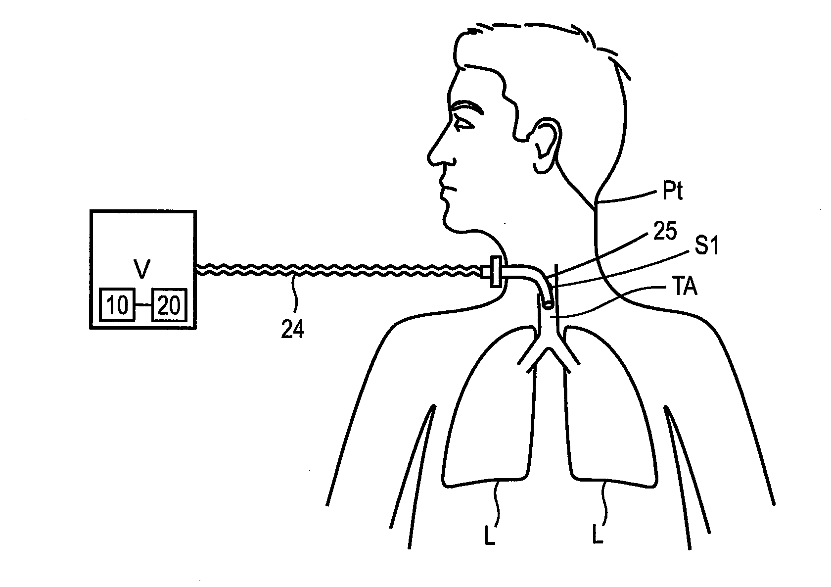 Methods and devices for sensing respiration and controlling ventilator functions