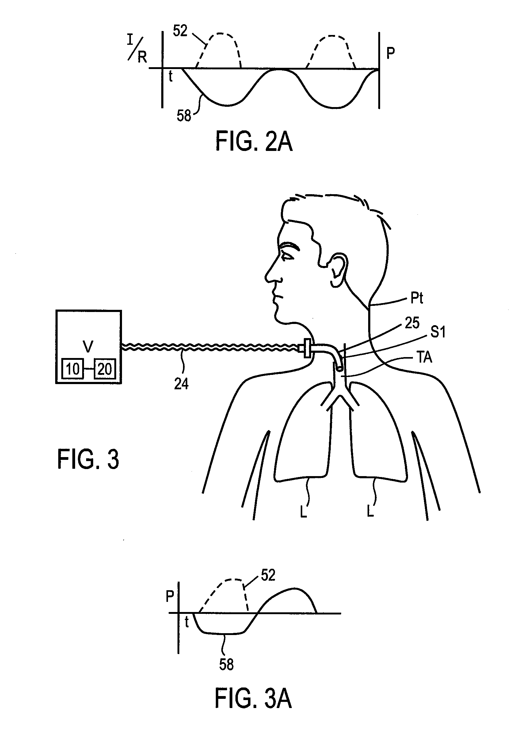 Methods and devices for sensing respiration and controlling ventilator functions