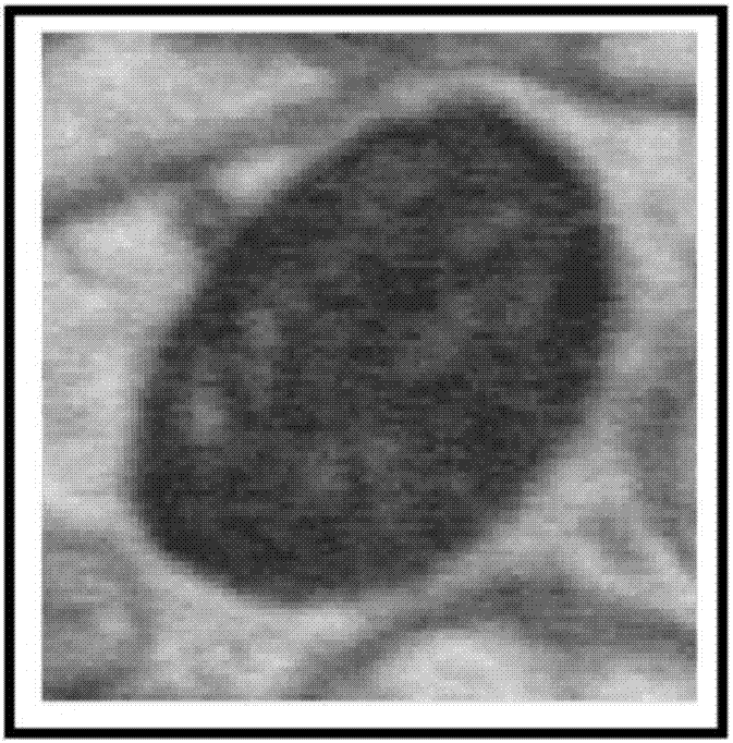 Image registration method and device based on mitochondrion structure, storage medium and equipment