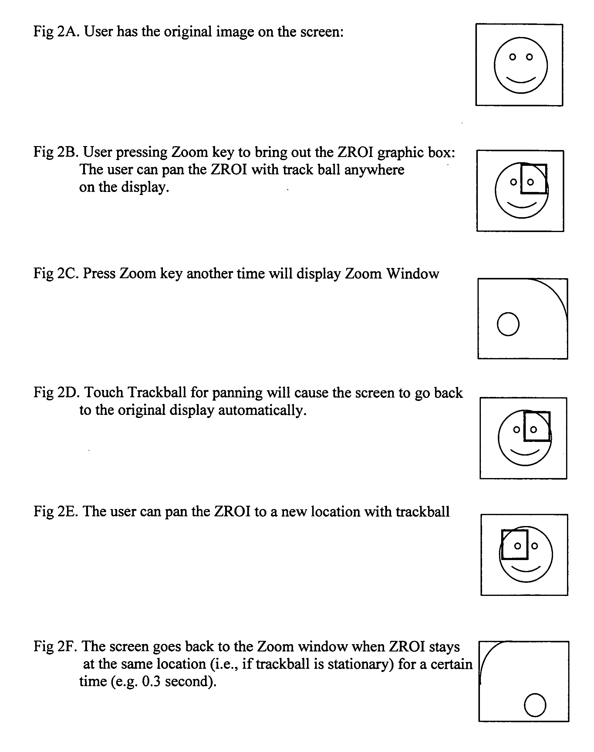 User interface for medical imaging including improved pan-zoom control