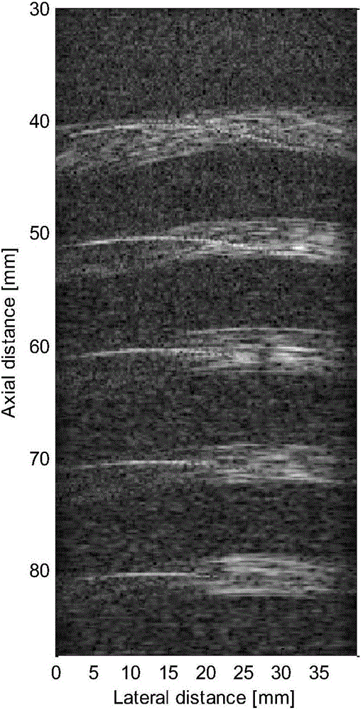 Anti-perspective plane transformation-based ultrasonic plane wave imaging method