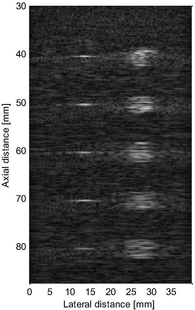 Anti-perspective plane transformation-based ultrasonic plane wave imaging method