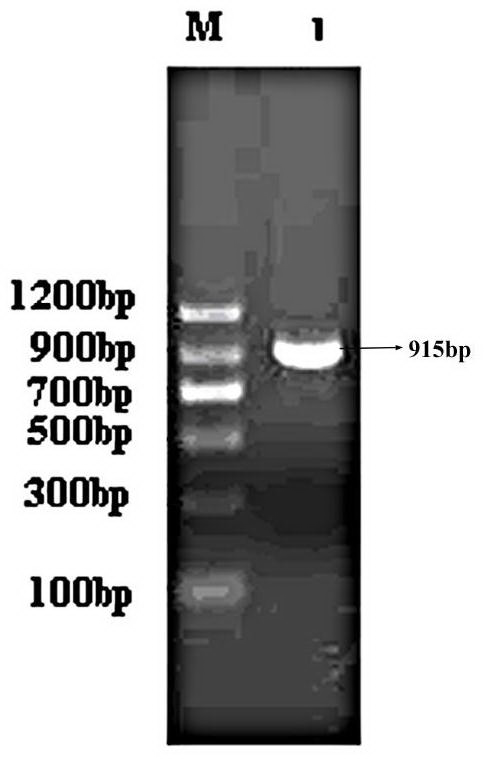 Human-derived urate oxidases with catalytic activity