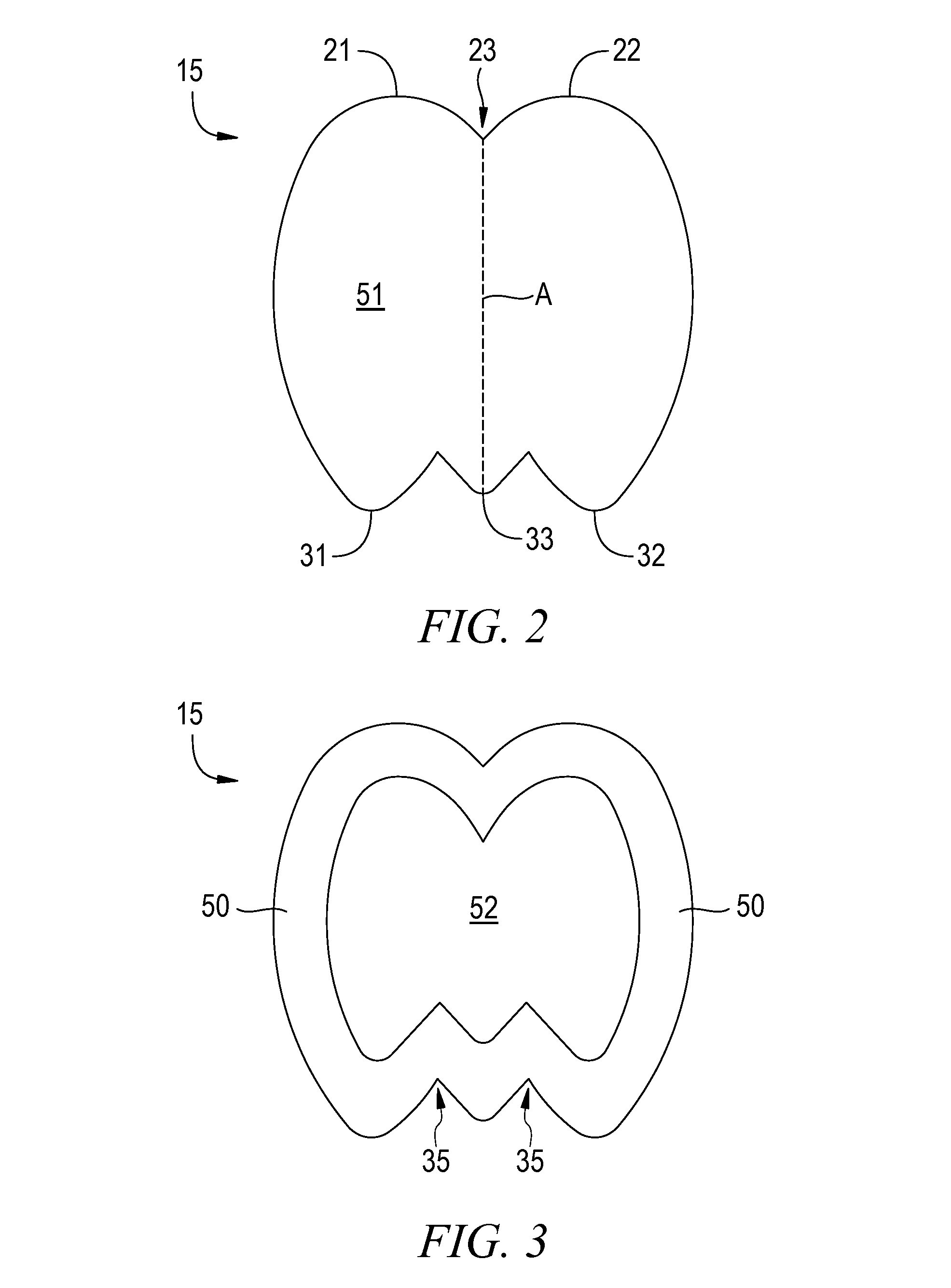 Method of use of a tulip-shaped sacral wound dressing